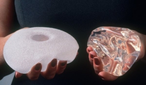 Every Breast Implant Operation in England to be recorded on a new Register