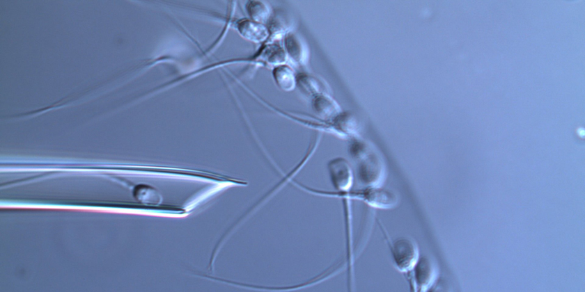Do we need to choose between improved sperm selection or efficacy ?